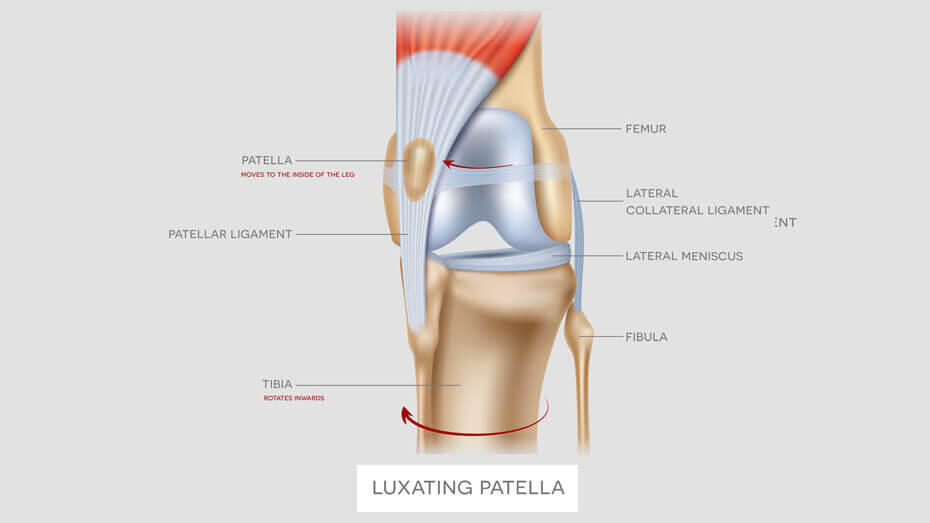 Luxating Patella in Dogs Symptoms and Treatment2